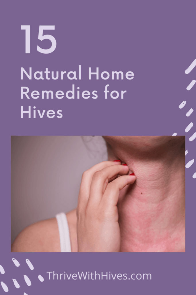 15 natural home remedies for hives. Shows woman scratching hives on neck. 